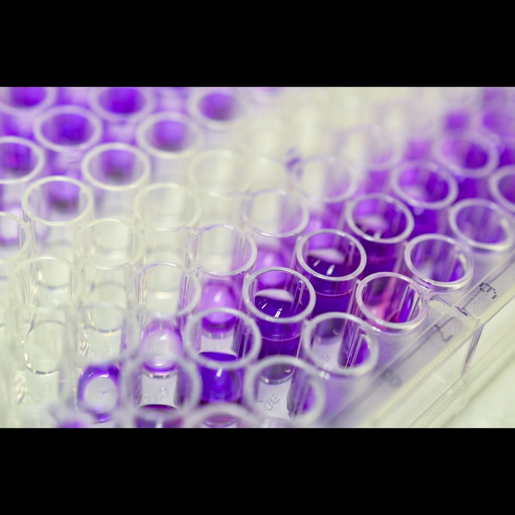 17size:Beta Estradiol  E2 , ELISA, 96size:test